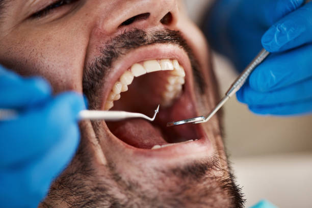 Best Broken Tooth Emergency  in Dania Beach, FL